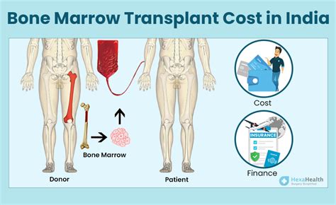 What is Bone Marrow Transplant? Procedure, Success Rate