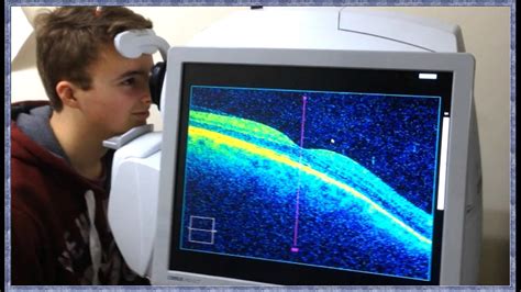 Optical coherence tomography angiography - laderlounge