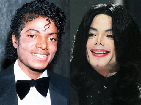 Michael Jackson - Celebrity Plastic Surgery Disasters? - Pictures - CBS News