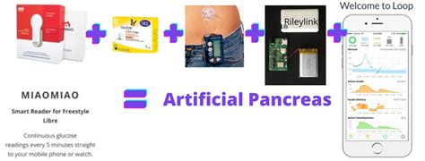 Artificial pancreas - now a reality | Diabetes South Africa