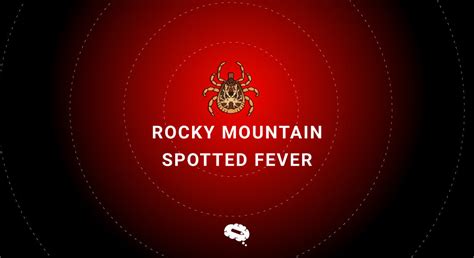 Rocky Mountain Spotted Fever: Symptoms, Treatment, and Prevention - Mind the Graph Blog