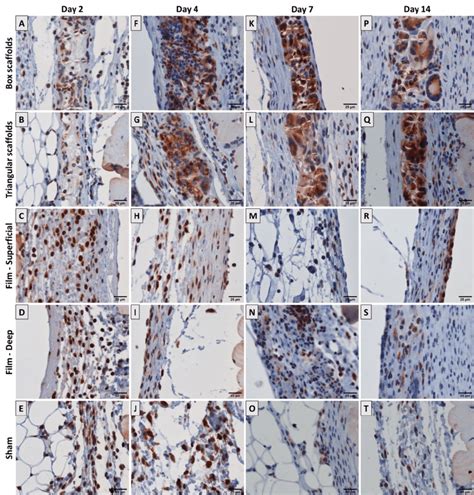 26. Representative images for IHC staining for CD68 as a pan-macrophage ...