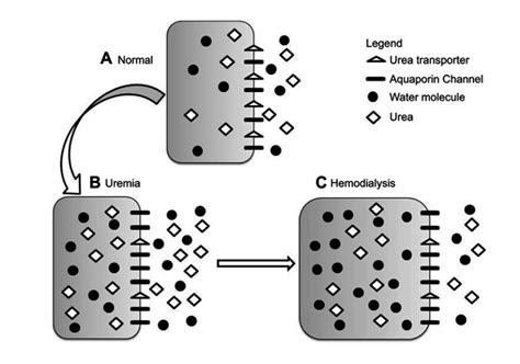 Dialysis disequilibrium syndrome prevention and management. - Abstract ...