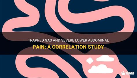 Trapped Gas And Severe Lower Abdominal Pain: A Correlation Study | MedShun