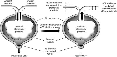 An Overview of ACE Inhibitors — tl;dr pharmacy