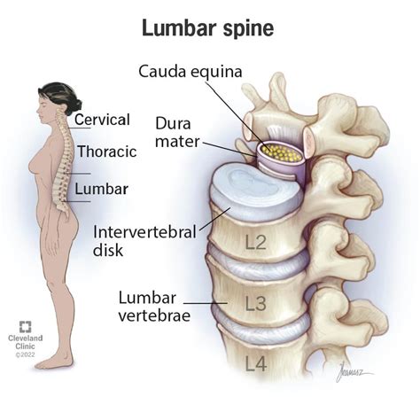 Human Lumbar Vertebrae With Cauda Equina Model Spinal Disc Herniation | Sexiz Pix