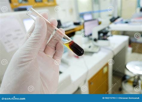 Clotted Blood with Serum in Tes Tube Stock Image - Image of chemistry ...