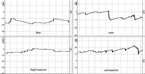 Change in the direction of horizontal nystagmus at different head ...