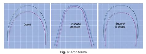 Figure 3 from Dental Arch Dimensions and Form in a Sudanese Sample ...