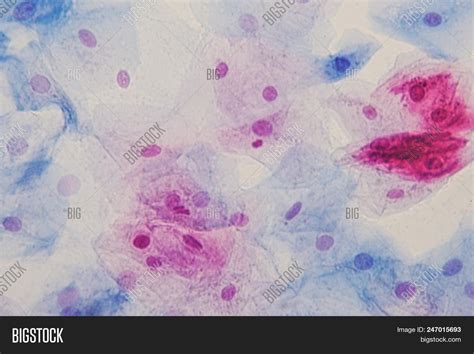 Squamous Epithelial Image & Photo (Free Trial) | Bigstock