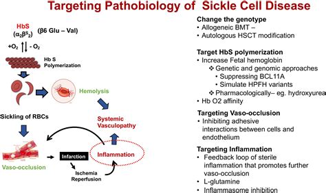 Crises In Sickle Cell Disease ScienceDirect, 42% OFF