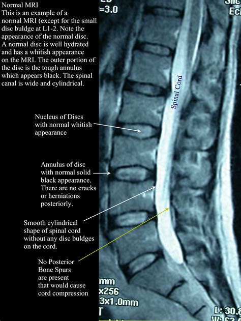 Imaging and the Lumbar Spine: What does it tell us? — AMP Healthcare Education