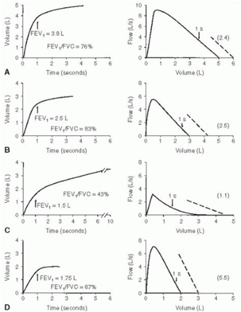 Spirometry: Dynamic Lung Volumes | Thoracic Key