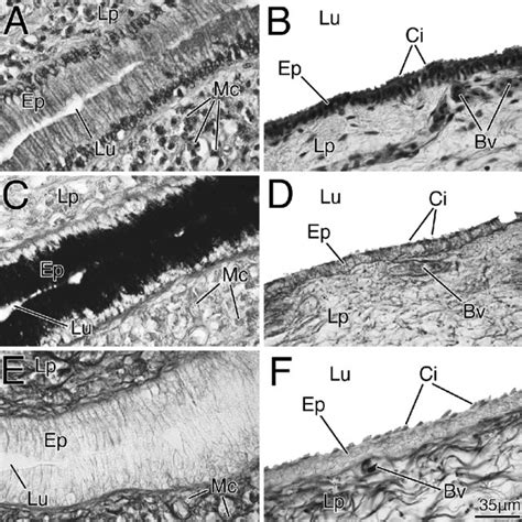 4 The Wolffian duct of Thamnophis sirtalis. A. Transverse section of... | Download Scientific ...