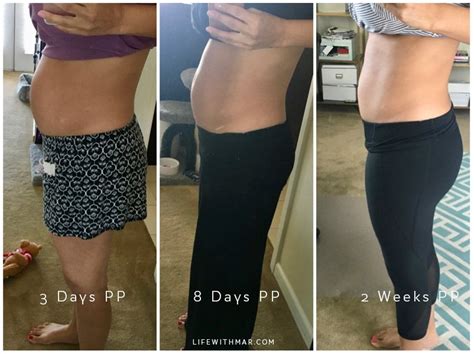 Bellefit Postpartum Girdle Review | Bellefit Before and After