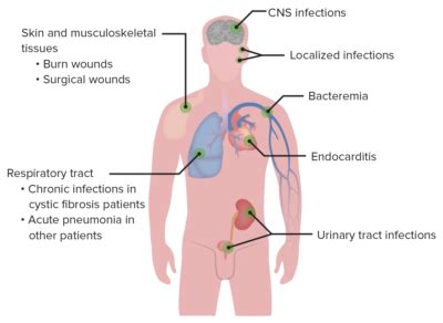 Pseudomonas | Concise Medical Knowledge