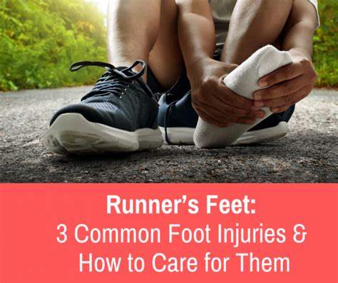 Runner’s Feet: 3 Common Injuries & How to Care for Them - Train for a 5K.com