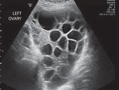 DMS443Wi2020: First Trimester Success vs Failures