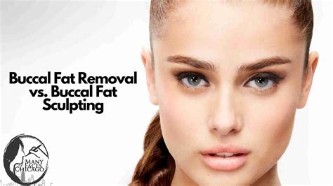 Buccal Fat Removal: What It Is, Recovery Before After, 54% OFF