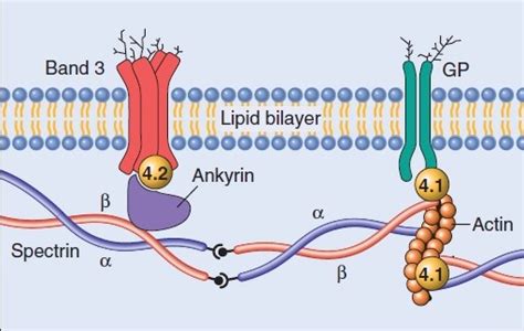 Hereditary Spherocytosis: Pathogenesis, Morphology, Clinical Features, and Treatment