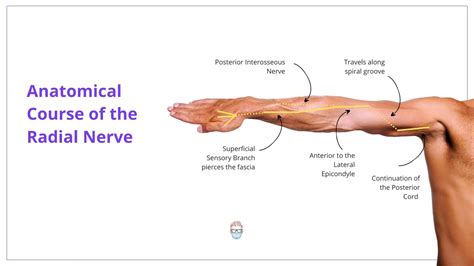 Radial Nerve Palsy