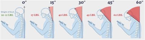 "Tech Neck" - The Health And Wellness Clinic