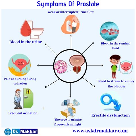 Prostrate Benign Prostatic Hyperplasia Hypertrophy Homeopathic ...