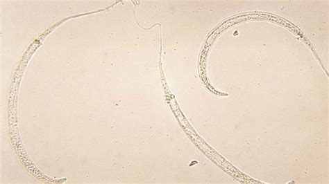 Guinea Worm Disease May Soon Be Eradicated | Mental Floss