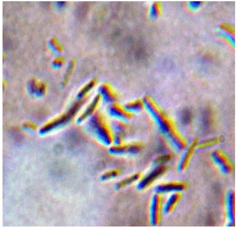 B. Fusobacterium necrophorum API 20A Identified from medium 10.Cells... | Download Scientific ...