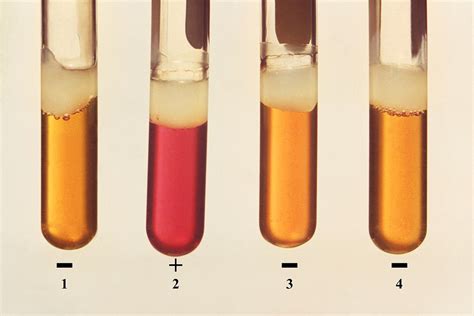 Four test tubes bacterial microorganism. | Free Photo - rawpixel