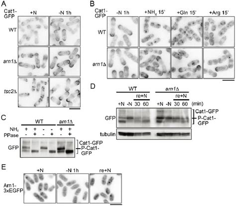 The localization of Cat1 is regulated in response to nutrient ...