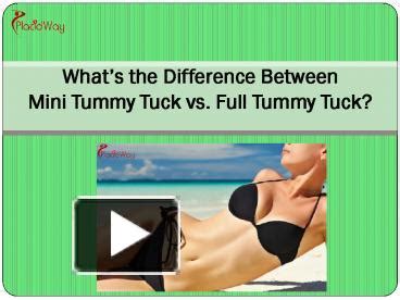 PPT – What is the Difference between Mini Tummy Tuck vs. Full Tummy Tuck PowerPoint presentation ...