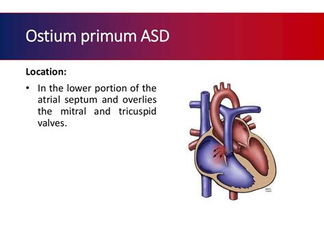 Atrial septal defect