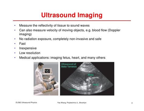 Physics of Ultrasound Imaging