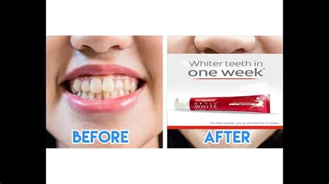 How Does Whitening Toothpaste Work