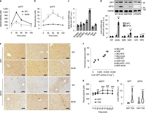 Alanine metabolism and liver ALT isoform expression is upregulated in... | Download Scientific ...