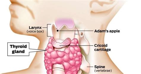 Papillary Thyroid Cancer Symptoms - CancerOz