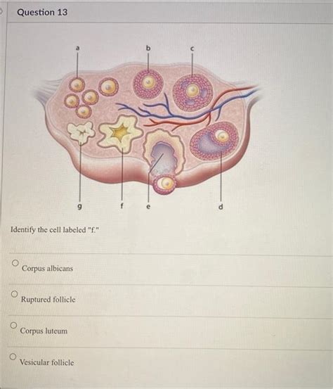 [Solved]: Identify the cell labeled "f." Corpus alb