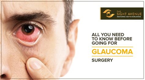 All You Need To Know before going for Glaucoma Surgery - The Sight Avenue