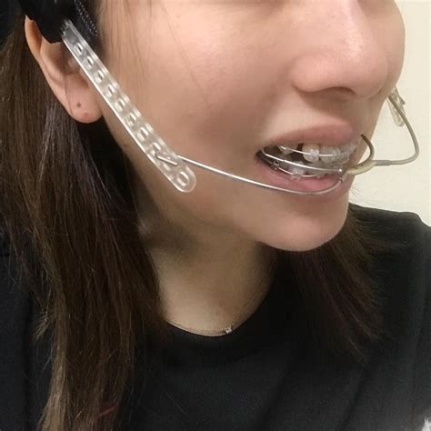 #braces #girlswithbraces #clearbraces #headgear #orthodontics # ...