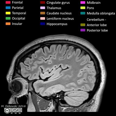 Brain lobes - annotated MRI (Radiopaedia 61691-69700 Sagittal) - NC Commons