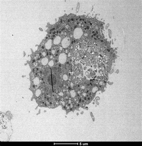 How the cholera bacterium survives water predators