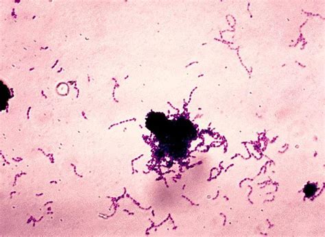 Streptococcus viridans: характеристика возбудителя и инфекции