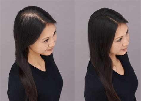 Why Is My Hair Thinning at the Part? - Toppik Blog