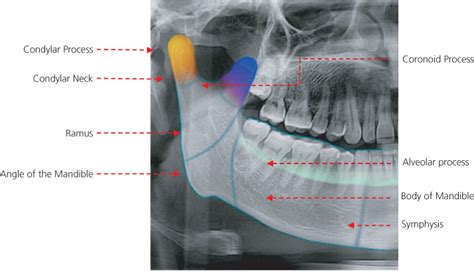 Face | Radiology Key