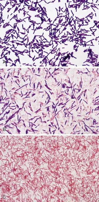 Gas Gangrene and Other Clostridium-Associated Diseases | Oncohema Key