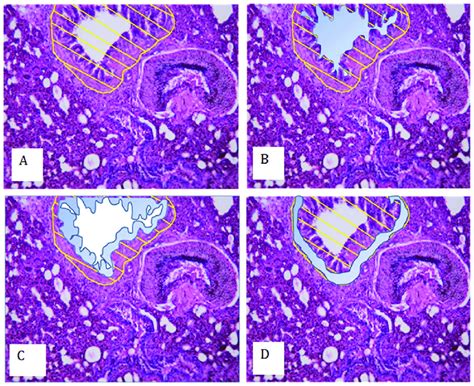 | Comparison of airway wall histology in offspring of control and... | Download Scientific Diagram