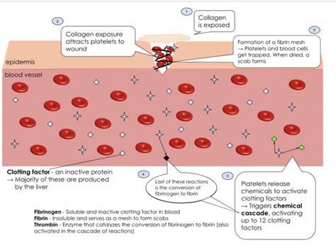 Thrombosis - Physiopedia