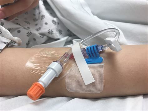 Optimal Dressing, Securement of Peripheral IV Catheters Not Yet Found - The Cardiology Advisor