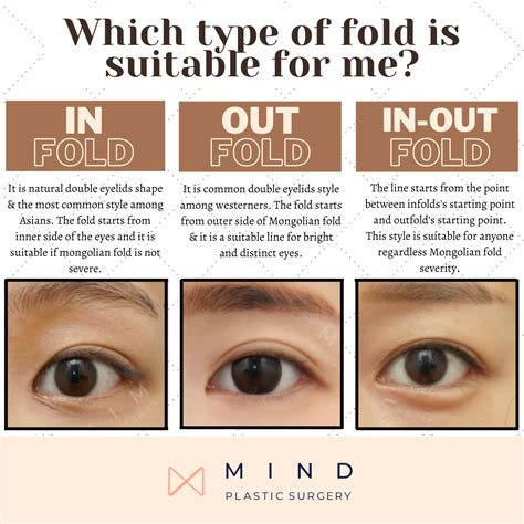 Types of Eyelids Fold :: MIND PLASTIC SURGERY | Getan